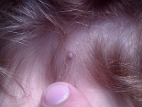 IMAG1820  Ewww! A big fat tick!