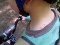 IMAG1933  I accidentally clawed Ben trying to slow him down. Looks like a snake bite, poor guy. Ben later said Eagle was flying along behind him and tried to save him, but the talons got him.