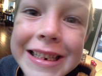 20141022 150851  Ben lost his first tooth!