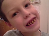 20150214 202705  My riding instructor, Janet, gave me these teeth she found in a drawer while cleaning. Halloween costume style teeth. Ben loved them :)